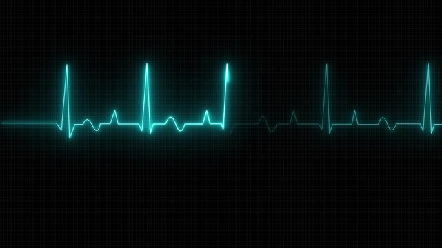 Heart beat pulse electrocardiogram show heart beat line icon animated video, One pulse line. ECG heartbeat monitor, ECG monitor, Heart beating and pumping 4k video