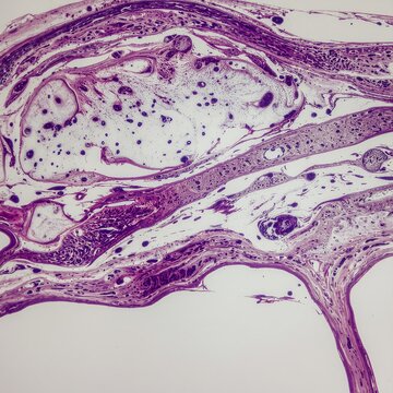 Histological section of human skin tissue under microscope.