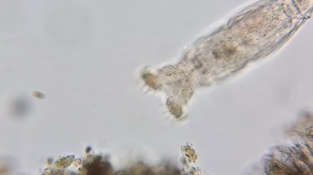 Microscopic view of a live rotifer moving in a freshwater sample 