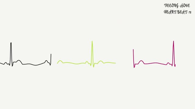 cardiograph recording: Artistic ecg heart rhythm visualization for diagnostics, suitable for medical presentations, cardiology websites, healthcare brochures, and hospital branding.