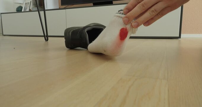 Close-up of a person removing a sock to reveal a fresh bleeding foot. Health, accident, care, and first aid concept in a home environment.
