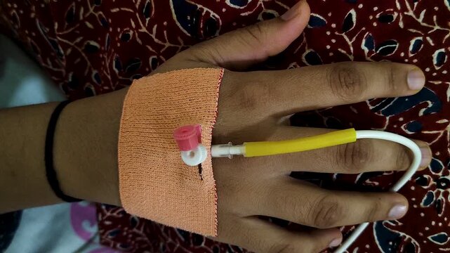Detailed close-up of IV cannula inserted in a patient's hand during hospital care. Ideal for healthcare, medical treatment, recovery, hospitalization, insurance and wellness content.