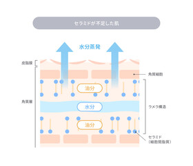 Obraz premium セラミド不足によるバリア機能の低下と水分蒸発を解説する肌断面図イラスト
