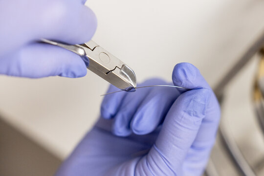 Orthodontist adjusting archwire with pliers braces treatment close up