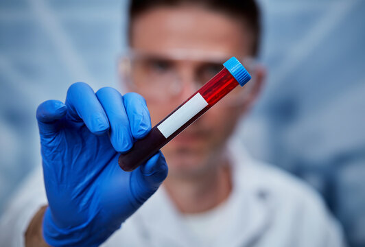 Blood sample identification, clinical laboratory specimen