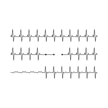 Three rows of black electrocardiogram heart rate lines with varying patterns and gaps on a white background, showing cardiac monitoring