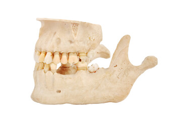 Human jaw bone model with teeth. © vetkit