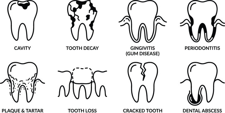 Dental Problems and Oral Disease Line Icon Set Featuring Cavity Tooth Decay Gingivitis Periodontitis Plaque Tartar Loss Crack and Abscess Symbols for Dentistry Presentations