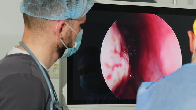 Detailed surgical monitor view during laparoscopic medical intervention. Doctor team conducts nasal endoscopy procedure in surgery room