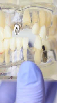 Dental laboratory typodont model with tooth roots for orthodontic practice