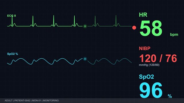 Medical monitor displays vital signs in a hospital setting with a heart rate