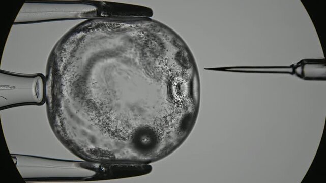 Microscopic View of Intracytoplasmic Sperm Injection ICSI Procedure Featuring a Large Translucent Oocyte Being Injected with Sperm in a Laboratory Setting