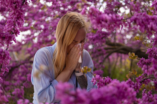 Woman experiencing spring allergies while surrounded by vibrant blooming flowers, suffering from hay fever, rhinitis, and seasonal discomfort outdoors