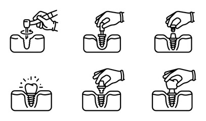 Obraz premium Dental Implant Procedure Icons, Tooth Restoration Steps, Surgical Process Graphics, Medical Treatment Icons, Oral Healthcare Vector Set