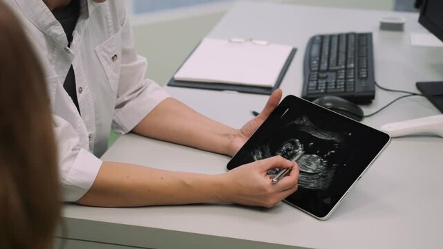 close up of a doctor working on a computer xray portable