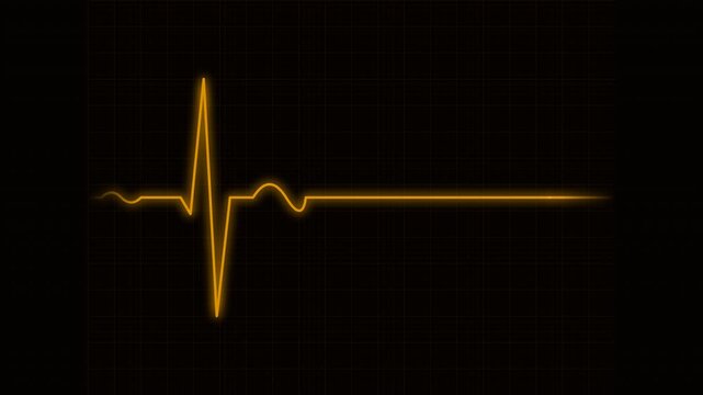 Heartbeat flatline electrocardiogram amber orange warning indicator wave looping on medical monitor display 4K
