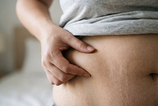 Hand pinches a fold of loose skin and fat on a bare lower abdomen over clothing