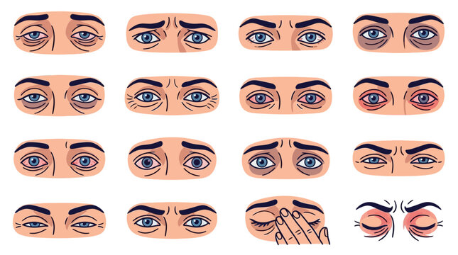 Set of Human Eye Symptoms and Conditions Illustration