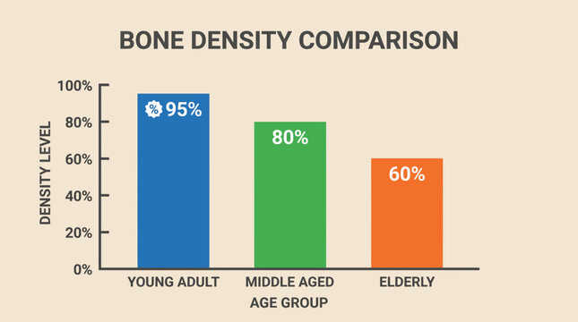 Bone Density Comparison Bar Graph Chart - Flat Vector Illustration