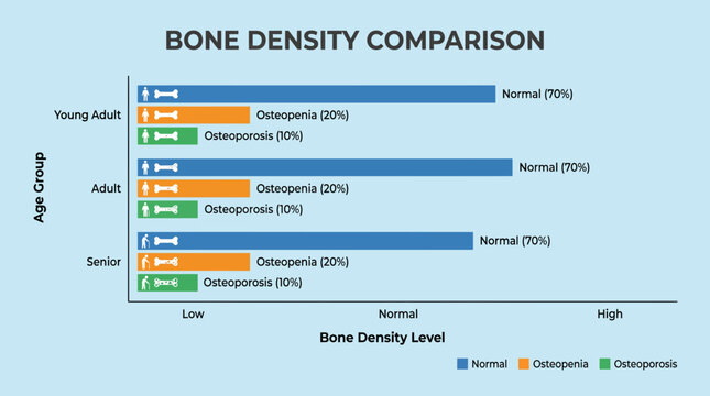 Bone Density Comparison Bar Graph Chart - Infographic Vector Template