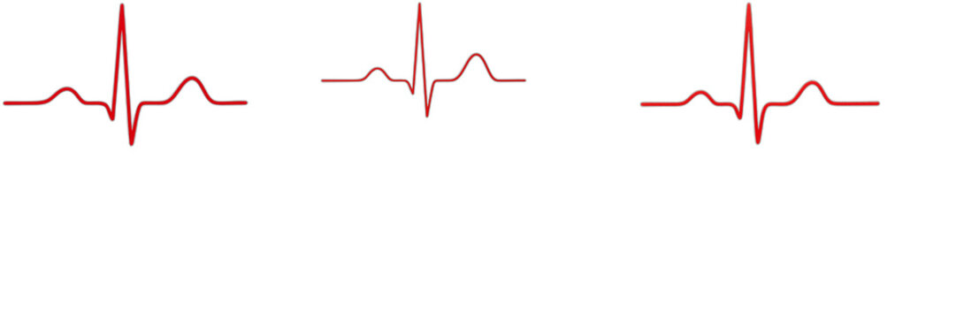 Heartbeat Line PNG Set - Red Ecg Ekg Pulse Waves Isolated on Transparent Background for Medical Healthcare Graphic Design, Cardiology Hospital Web Elements, Cardio Fitness Clipart Digital Stock Asset 
