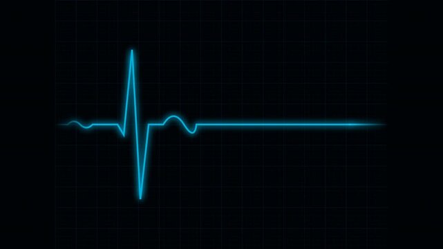 Heartbeat flatline electrocardiogram cyber blue tech monitoring signal animation on futuristic grid interface 4K