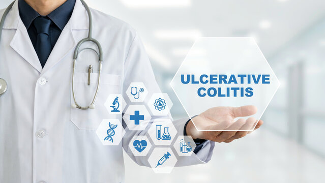 Medical professional presenting ulcerative colitis diagnosis hologram
