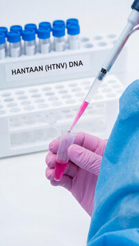 Close-up of a scientist in a blue gown and pink gloves using a pipette to transfer pink fluid into a microtube. Hantaan HTNV DNA research on virus vaccine in a modern sterile laboratory.