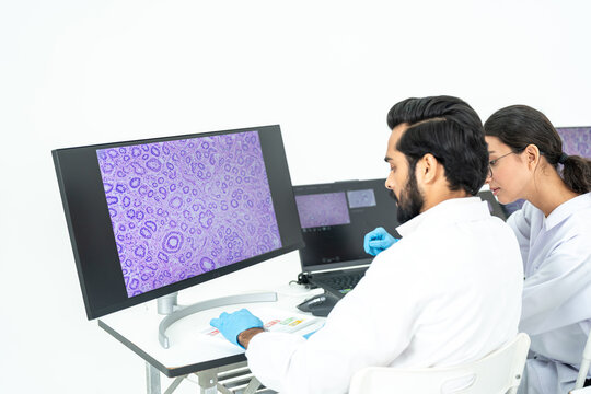 Male and female researchers examining purple cell tissue image on big screen, digital pathology and histology analysis in bright laboratory.