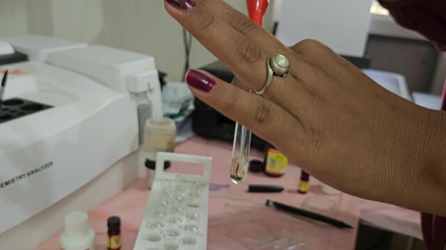 Laboratory Technician Dispensing Laboratory Sample into Test Tube Using Micropipette, Clinical Diagnostics, Medical Laboratory Research, Sample Preparation, Biotechnology, 4K Cinematic Footage