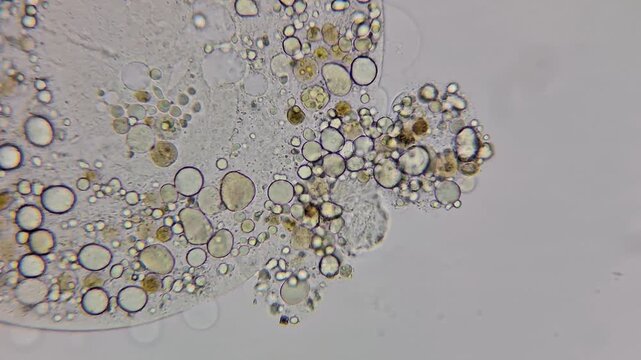 Microscopic view of a testate amoeba with a ruptured test 