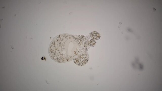 Microscopic view of a testate amoeba with a ruptured shell. 