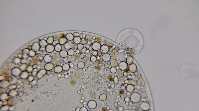 Microscopy of testate amoeba undergoing binary fission cell division 