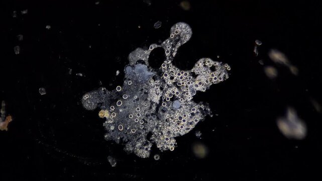 Amoeba under darkfield microscope - Microbiology research
