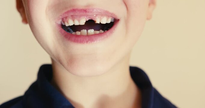 Little boy smiling and showing a missing tooth