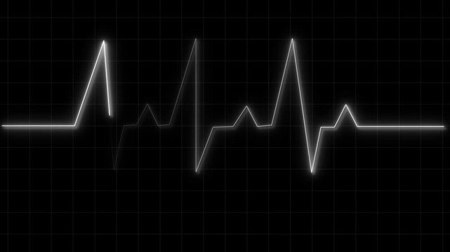 White electrocardiogram line on a dark grid background heart rate pulse animation