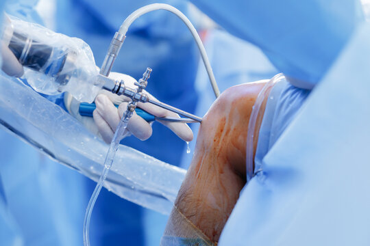 Knee Arthroscopy Procedure with Meniscus Repair Tools in Surgery