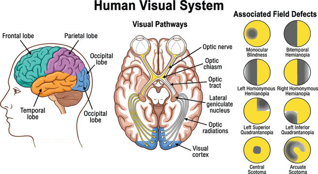 Human visual system medical infographic vector diagram showing brain lobes pathways optic nerves and associated field defects