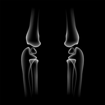 Human elbow joint skeleton vector illustration isolated on black background. X-ray style front view of elbow bones pair, anatomy humerus radius ulna for medical poster, arm care, health design.