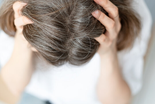 Close up of a woman experiencing both hair loss and premature graying at same time. The mature adult faces multiple distressing hair changes together. Mother worries about thinning and early silver.