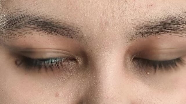 Woman with eye discomfort and watery eyes, vision problems and eye health concept, ophthalmology and healthcare.