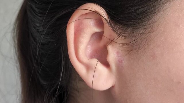 Human ear close up, hearing problems and ear disorders concept, otolaryngology, medical checkup and health care.