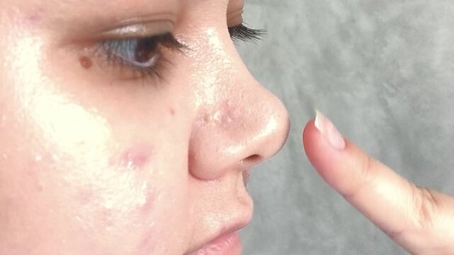 Close up of woman examining her nose, nasal health, ENT medicine, sinus and facial anatomy concept.