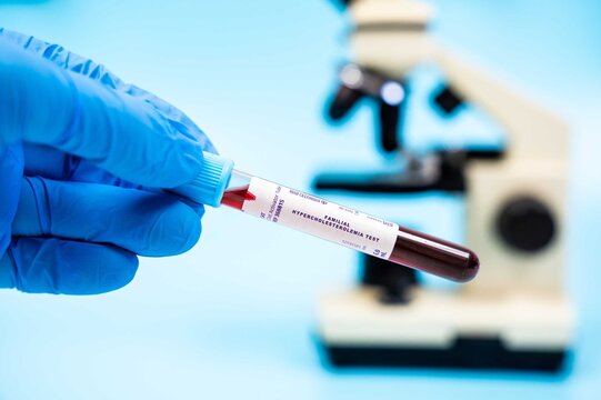 Detects mutations in LDLR, APOB, or PCSK9 genes, leading to