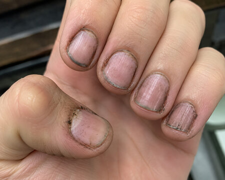 Dirty fingernails close up after manual work