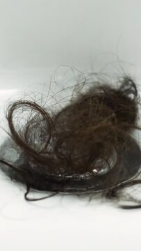 Feet and pile of hair loss in a bathroom after washing hair.Hair fall everyday serious problem, on white background.Solutions for hair loss.