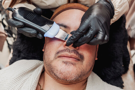 An ultrasonic skin scrubber facial treatment on the nose area of a patient to deeply cleanse pores, exfoliate dead skin, and improve overall skin texture at a professional aesthetic clinic.