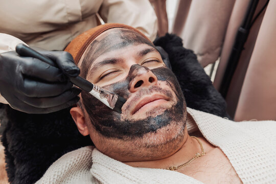 Aesthetic practitioner applies a medical-grade carbon paste mask to a man's face as preparation for a Carbon Laser Facial, also known as a Hollywood Laser Peel.