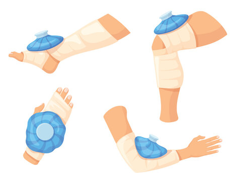 Ice compress. Cold pack bag gel heal pain therapy, leg foot ankle sprain injury hand muscle heat bruise trauma applying first aid swollen broken bone toe neat vector illustration