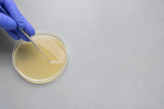 Gloved hand streaking agar plate in laboratory